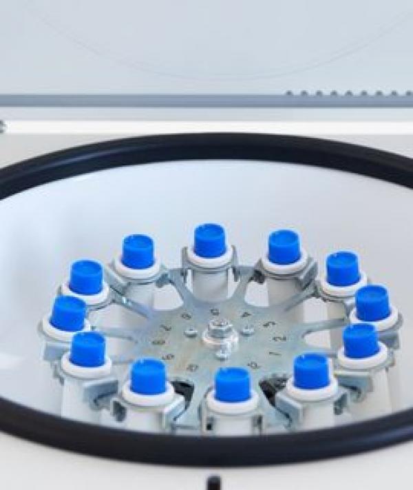 CENTRO DE FISIOTERAPIA Y REHABILITACIÓN FÍSICA SALUD Y VIDA PLASMA RICO EN PLAQUETAS EN ARTICULACIÓN (PRP)